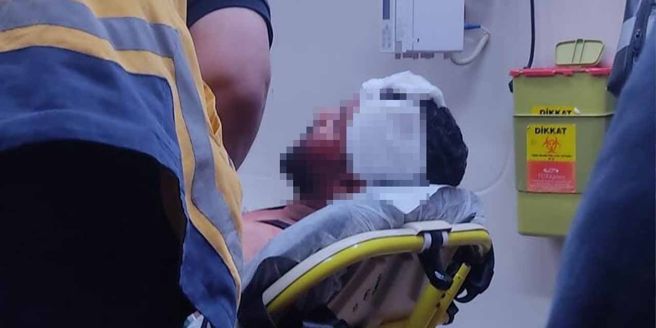 Yabancı uyruklular arasında çıkan kavgada kan aktı