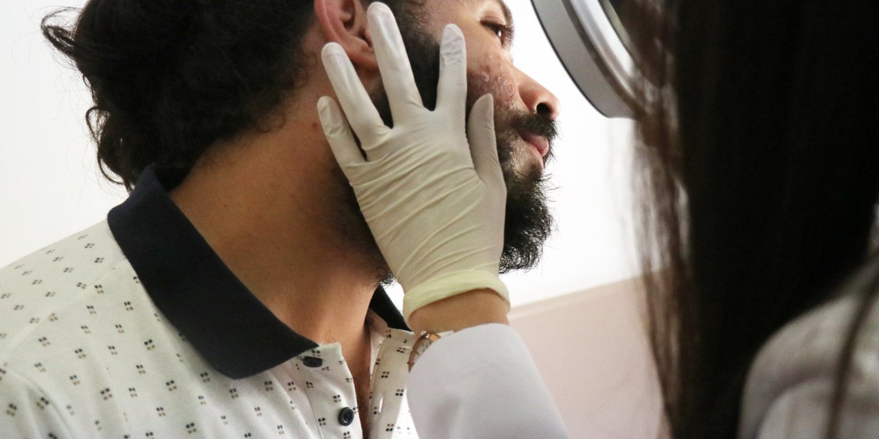 Vücudunuzda bu yaralardan çıkıyorsa temastan kaçının