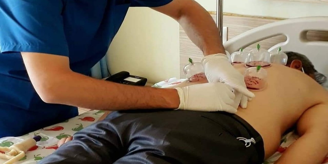 Uzmanı hacamatta yanlış uygulamalara karşı uyardı
