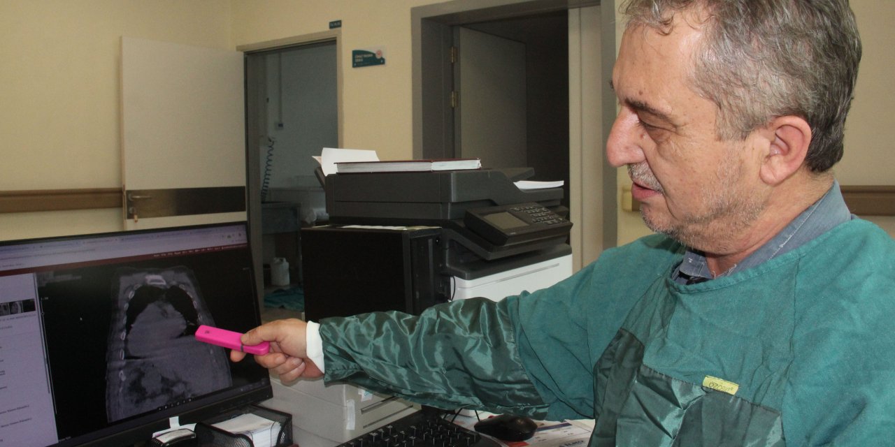 "Karadeniz sendromu"