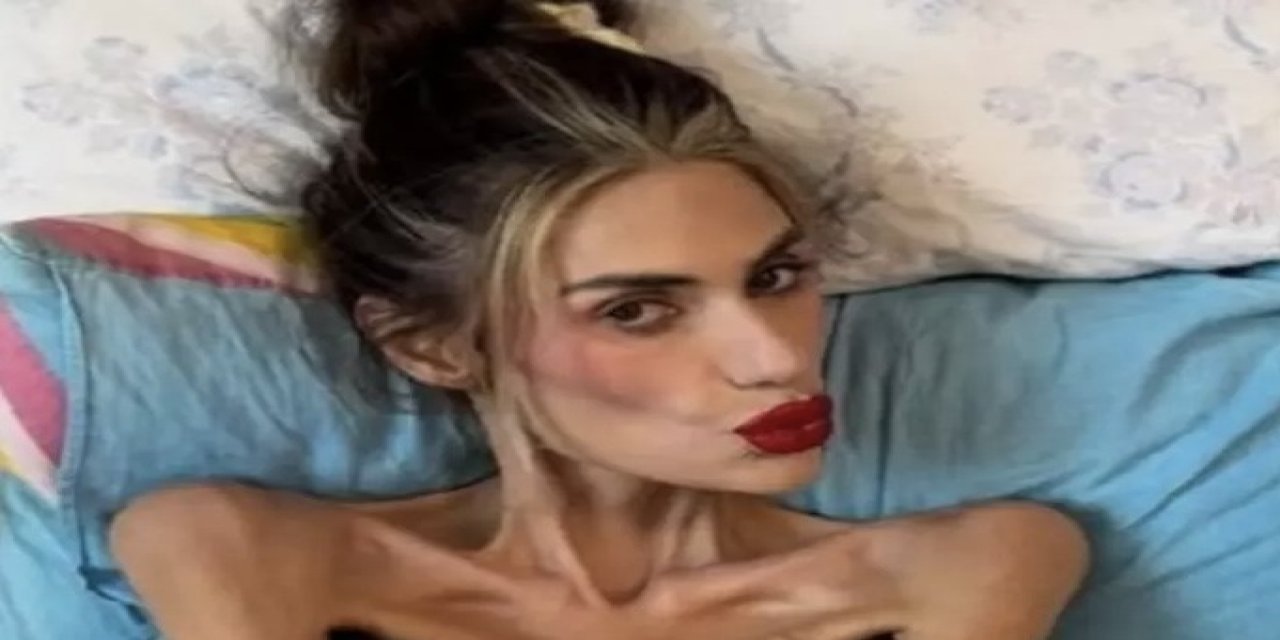 23 kiloya düşmüştü! Nihal Candan hayatını kaybetti