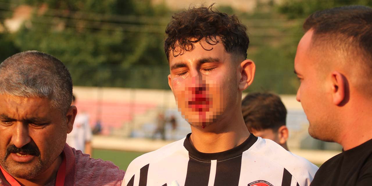 Hastanelik oldu ama penaltı çalınmadı!