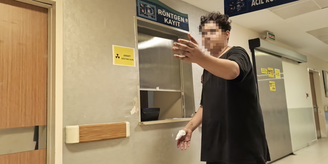 Motosikletin dönen zincirine elini kaptırdı