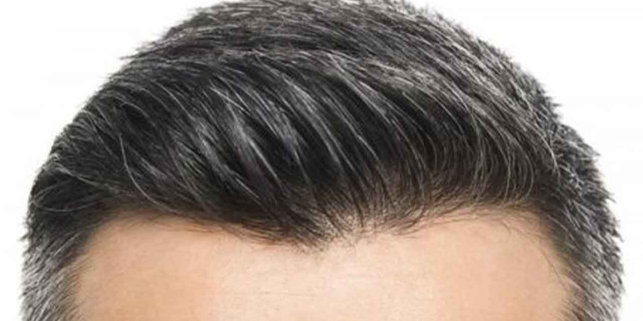 Ağustos'ta Aldığınız Güneş Ekim'de Saçınızı Döküyor