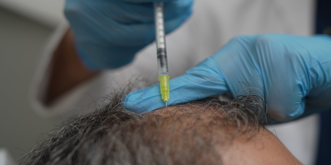 Dökülen saçlar vücudun bir alarmı olabilir