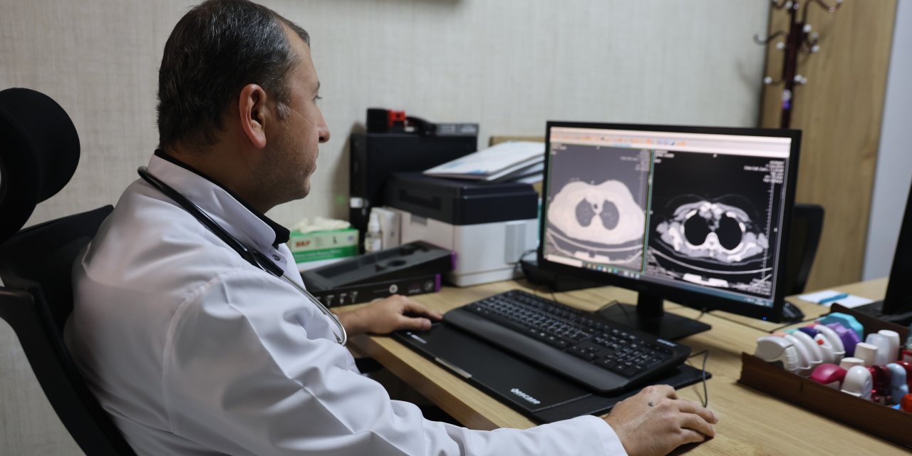 "Akciğer kanserinin en önemli risk faktörü sigara kullanımıdır"