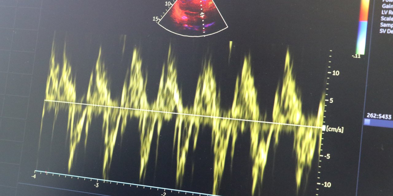 "Kalp hastaları soğuk havalarda dikkatli olmalı"
