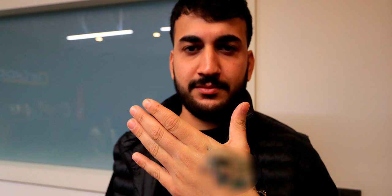 Dövmesini sildirmek için gittiği güzellik merkezi elinden ediyordu