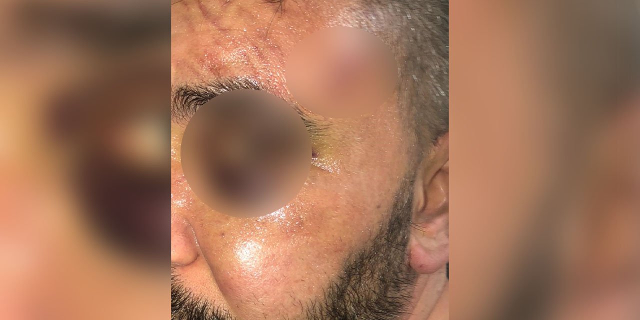 Dükkan basan 3 kişi patronu öldüresiye darp etti