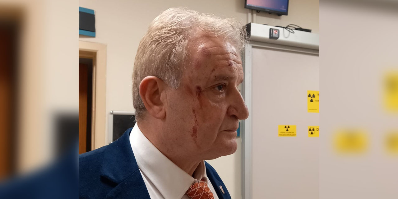 Eskişehir'de gazeteciye çirkin saldırı