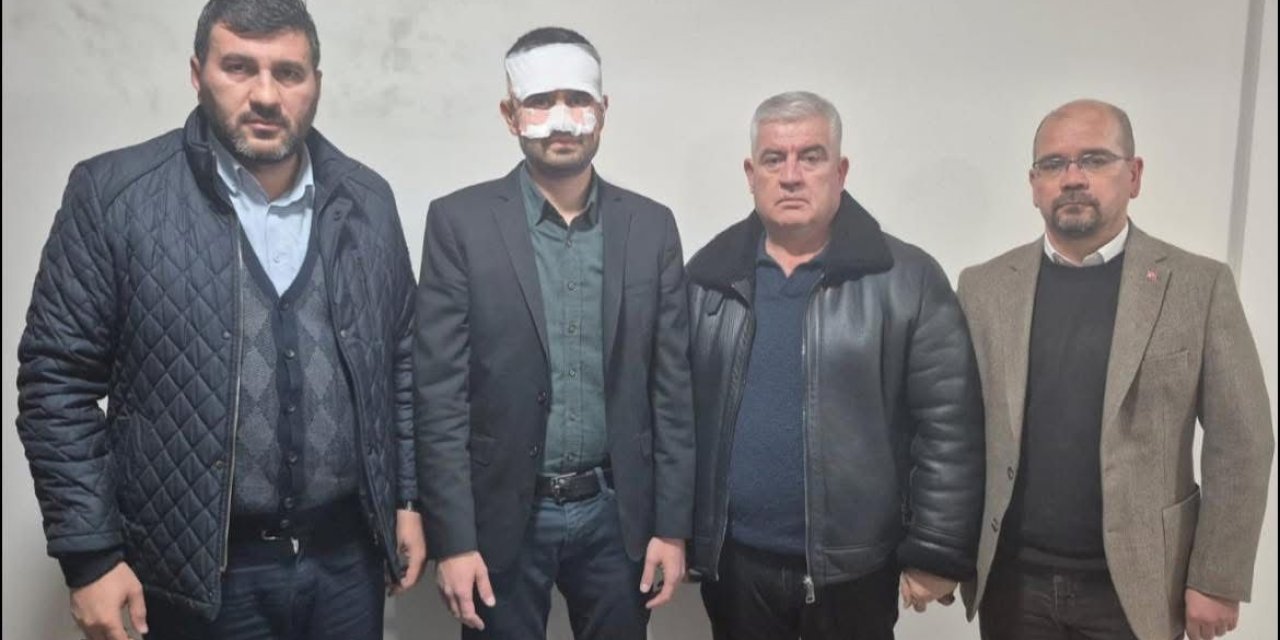 Eskişehir'de öğretmene çirkin saldırı!