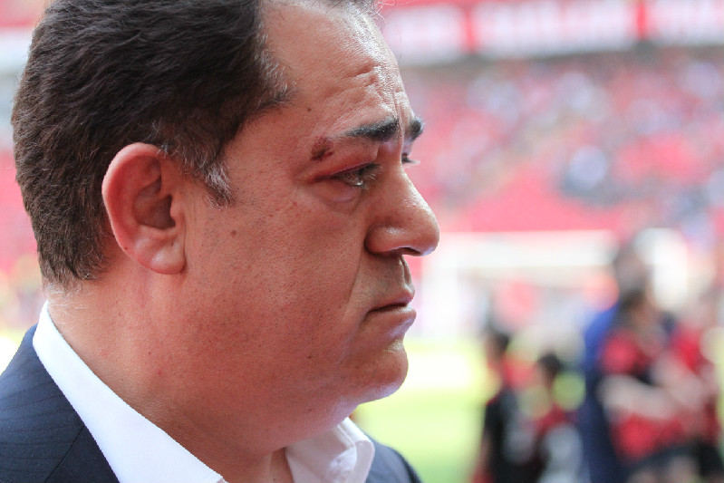 GEÇMİŞ OLSUN BAŞKAN!