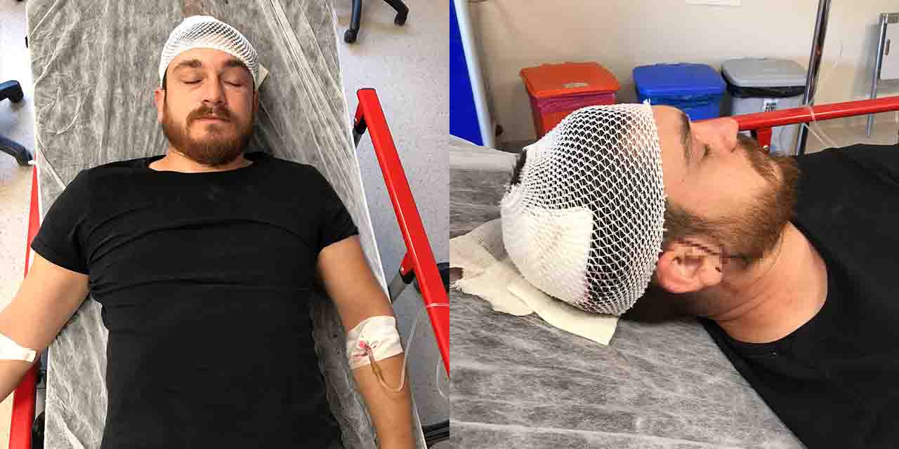 Trafikte tartıştığı kişiyi çekiçle darp etti